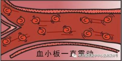 血小板是正常值的三倍？專家提醒小心血栓和出血！