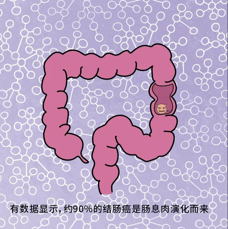 奪走“黑豹”生命的結腸癌，到底什么來頭？