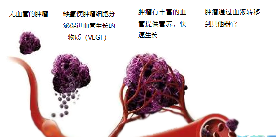 晚期腫瘤為什么會復(fù)發(fā)轉(zhuǎn)移？