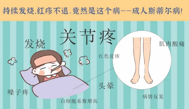 持續(xù)發(fā)燒、紅疹不退……她終于在這里治好了這個罕見病