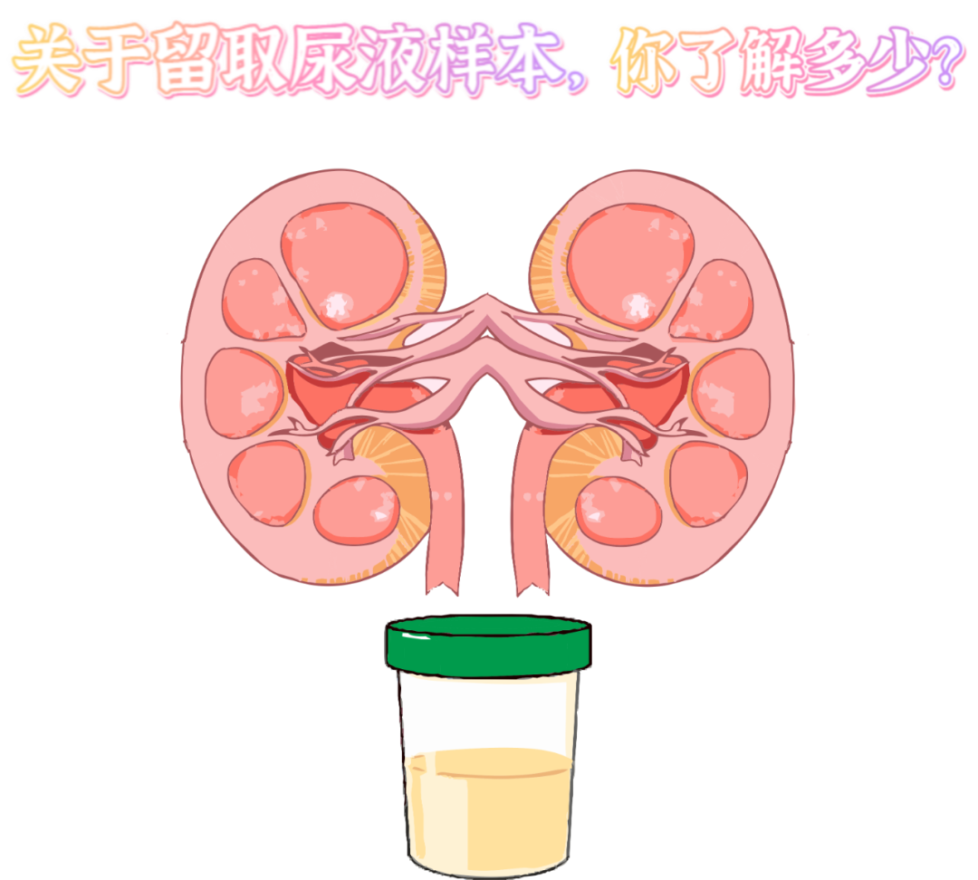 做尿檢，不得不說的注意事項！