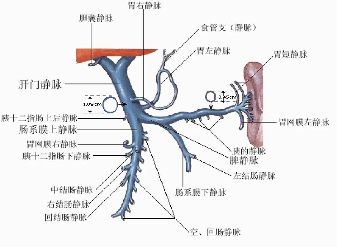 反復(fù)嘔血、黑便怎么辦？TIPS手術(shù)能解決