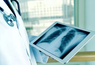 健康呼吸④體檢發(fā)現(xiàn)肺結(jié)節(jié)，我該怎么辦？