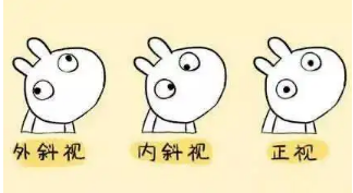 小baby老歪著頭？警惕斜頸! 這樣糾正……