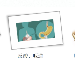 關(guān)愛身體健康，輕松檢查胃腸