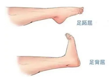 扭胯小連步、動感搖花手……“科目三”雖火，運(yùn)動損傷也要防！